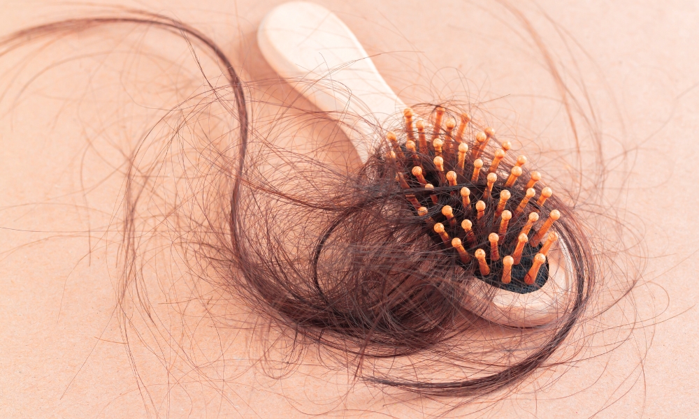 Opadanje kose prevazilazi normalu kada primetiš naglo povećanje dlaka na četki, jastuku ili pod tušem